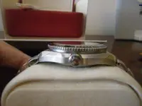 Lateral corona1.webp