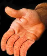 mano con criollos web.webp