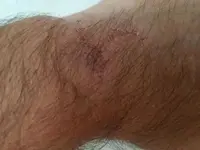 Muñeca Lastimada.webp