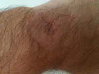 20180119_173643.webp